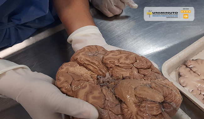 Experiencia Cerebro humano 
